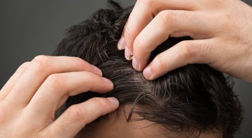 Glia Innovation apresenta ingrediente que reverte os cabelos grisalhos