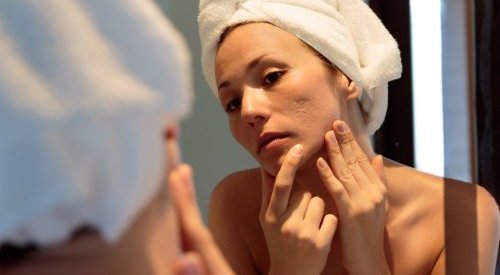 Mudança de comportamento do consumidor faz indústria avançar no cuidado da acne
