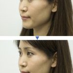  Antes e depois da aplicação da Make-up Sheet (Foto: Courtesy of Panasonic)