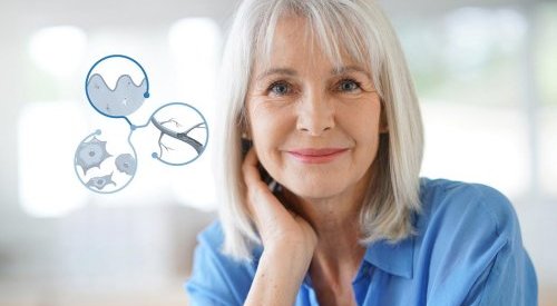 Silab reconecta fibroblastos envelhecidos para regenerar peles maduras