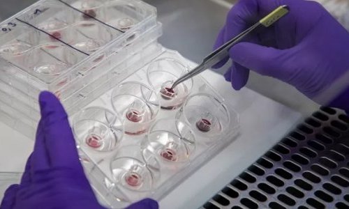 Episkin lança modelo de córnea humana para evitar testes de produtos em animais