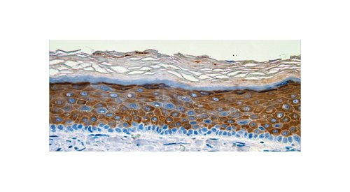 BASF and CTIBiotech: First 3D bioprinted human skin including immune macrophages