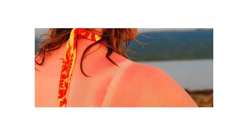 Autobronzeadores: uma nova substância pode ajudar a pele a produzir melanina sem raios UV