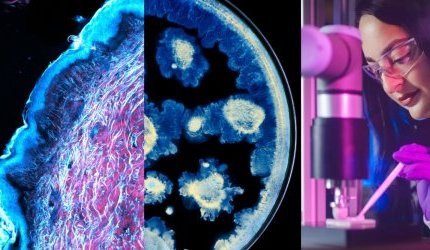 L'Oréal e o Instituto Pasteur unem forças para avançar na pesquisa sobre a pele