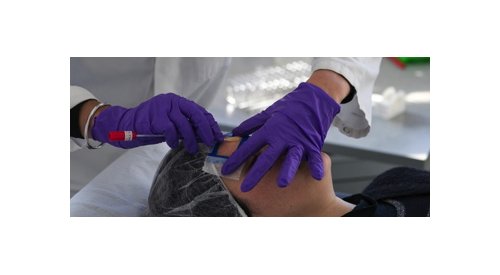 Silab evidencia modificações na microbiota de peles caucasianas de mulheres maduras