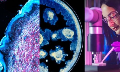 L'Oréal e o Instituto Pasteur unem forças para avançar na pesquisa sobre a pele