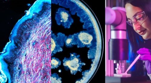 L'Oréal e o Instituto Pasteur unem forças para avançar na pesquisa sobre a pele