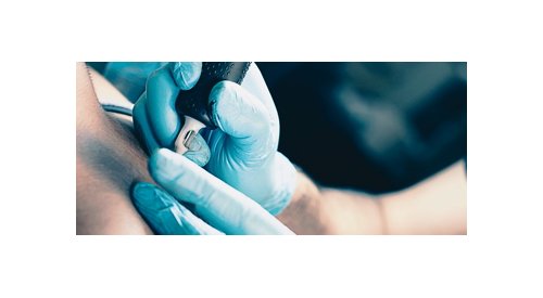 A tinta de tatuagens pode se acumular nos gânglios linfáticos, alerta um novo estudo