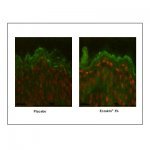 Ecoskin®[pt_br]Fig. 3: imunomarcação das β-defensinas 3 (Verde fluorescente) após a aplicação tópica do placebo vs. o creme-teste com Ecoskin®