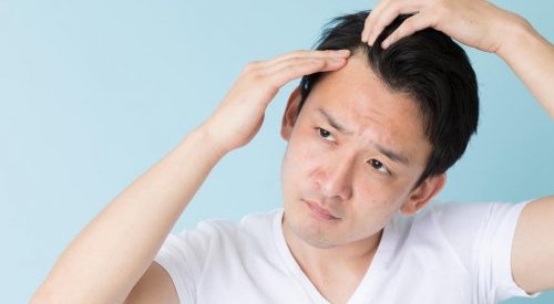 Estudo: Sulforafano, uma nova arma para combater a queda de cabelo?