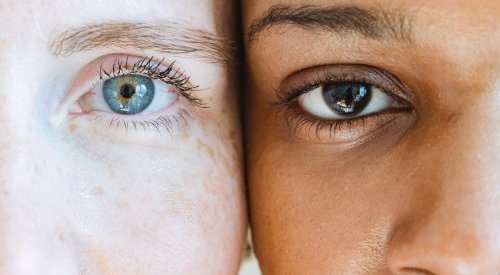 Myralys, ativo da Greentech que tonifica as pálpebras, regenerando o olhar