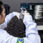 Equipamento analisa em tempo real o couro cabeludo e folículos capilares