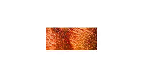 Startups look to annatto to treat atopic dermatitis
