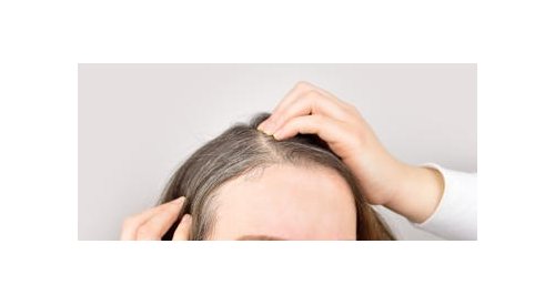 We now know why hair turns grey under stress